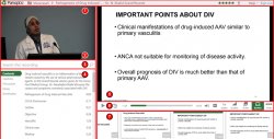 Screenshot highlighting the different aspects of the Panopto Viewer