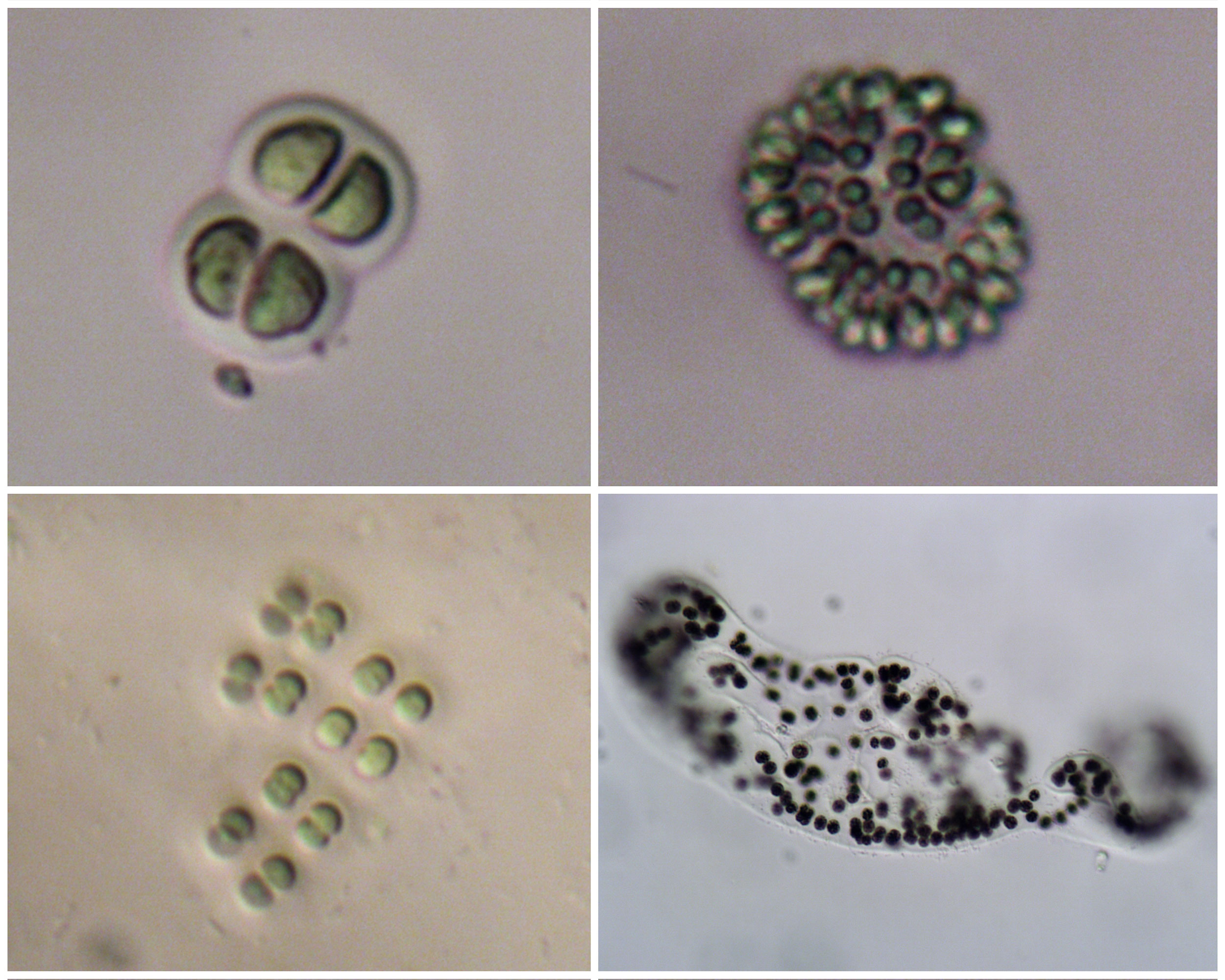 Visual Guide To Cyanobacteria In New Jersey – New Jersey Center For ...